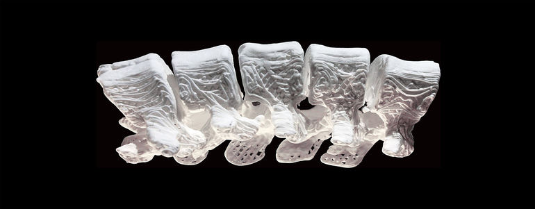 Кости можно вырастить с помощью 3d печати биоразлагаемых имплантов