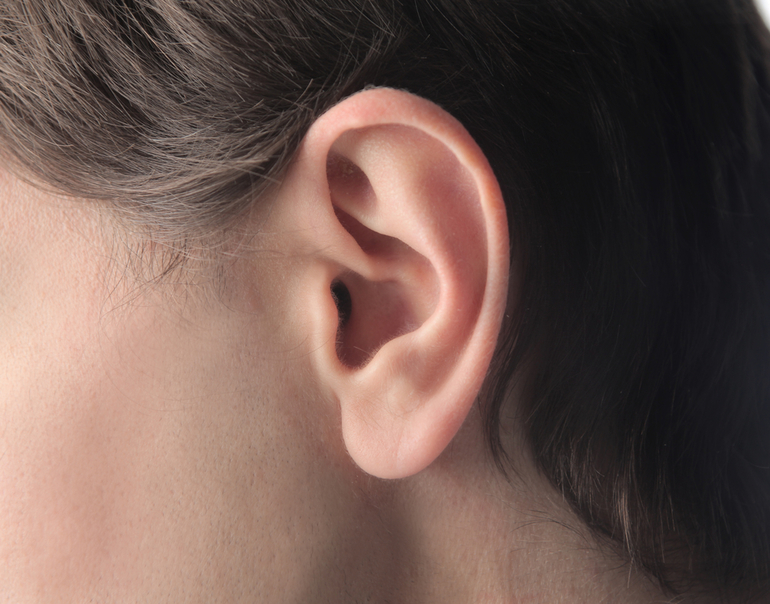 3d принтер напечатал уши для детей с недоразвитием ушной раковины