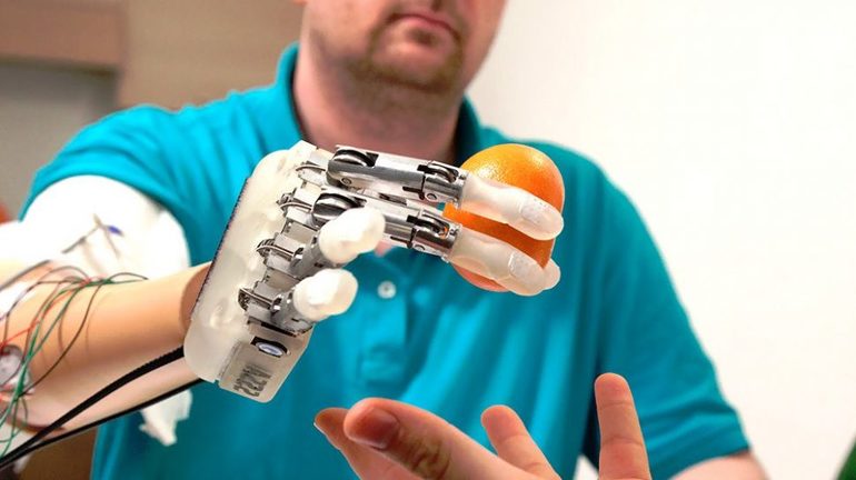 Использование алгоритмов ИИ в обучении роботизированных протезов