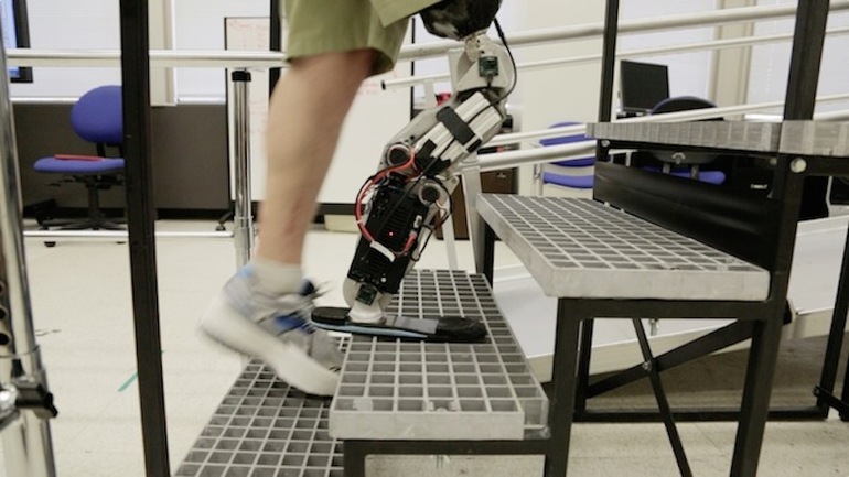 Новые возможности и перспективы роботизированных протезов